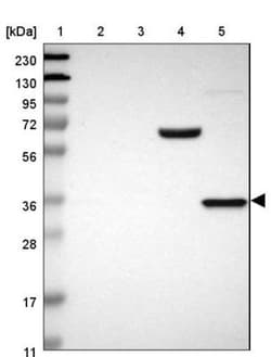 QPRT Antibody, Novus Biologicals 0.1mL; Unlabeled:Antibodies, Polyclonal