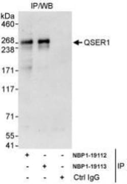 QSER1 Antibody, Novus Biologicals 0.1mL; Unlabeled:Antibodies, Polyclonal