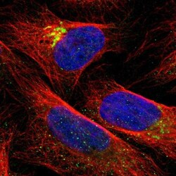 QSOX2 Antibody, Novus Biologicals 0.1mL; Unlabeled:Antibodies, Polyclonal