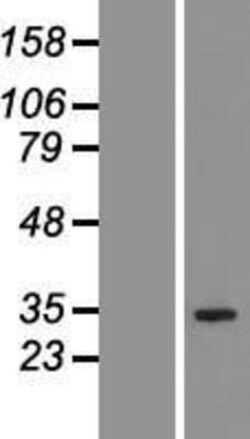 Novus Biologicals&trade;&nbsp;QTRT1 Overexpression Lysate