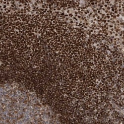 QTRTD1 Antibody, Novus Biologicals 0.1mL; Unlabeled:Antibodies, Polyclonal