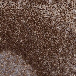 QTRTD1 Antibody, Novus Biologicals 0.1mL; Unlabeled:Antibodies, Polyclonal