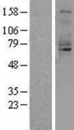 Novus Biologicals&trade;&nbsp;QSOX1/Quiescin Q6 Overexpression Lysate
