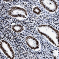 R3HCC1 Antibody, Novus Biologicals:Antibodies:Primary Antibodies