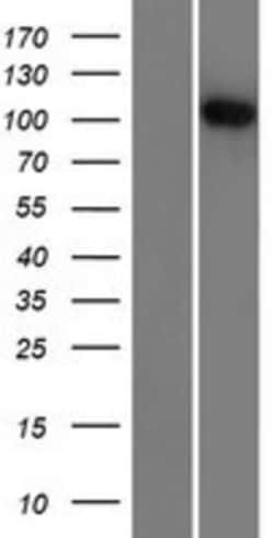 Novus Biologicals™ R3HDM2 Overexpression Lysate