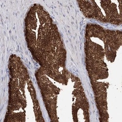 R3HDM2 Antibody, Novus Biologicals:Antibodies:Primary Antibodies