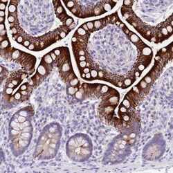 R3HDM4 Antibody, Novus Biologicals 0.1mL; Unlabeled:Antibodies, Polyclonal
