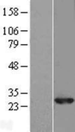 Novus Biologicals&trade;&nbsp;RAB10 Overexpression Lysate