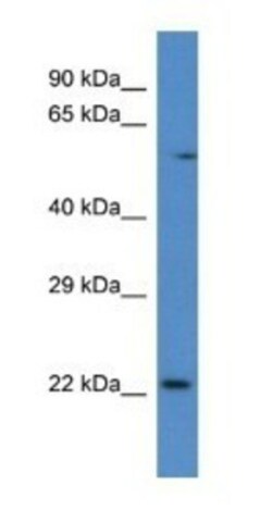 RAB10 Antibody, Novus Biologicals 100 &mu;L | Buy Online | Novus Biologicals | Fisher Scientific