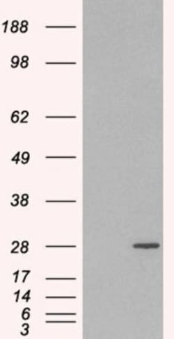 Rab11A Antibody, Novus Biologicals 0.1mg; Unlabeled:Antibodies, Polyclonal
