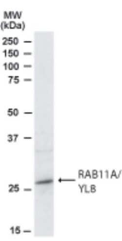 Rab11A Antibody, Novus Biologicals 0.1mg; Unlabeled:Antibodies, Polyclonal