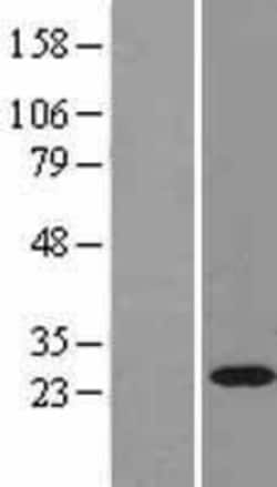 Novus Biologicals&trade;&nbsp;Rab11A Overexpression Lysate