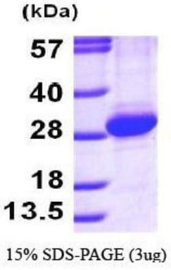 Novus Biologicals Recombinant Human Rab11A His Protein 0.1 mg | Buy Online | Novus Biologicals&trade; | Fisher Scientific