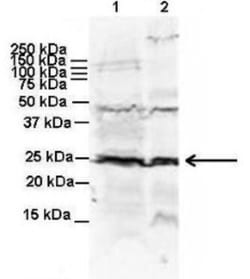 Rab11 Antibody, Novus Biologicals 0.05mg; Unlabeled:Antibodies, Polyclonal