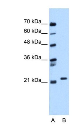 Rab11 Antibody, Novus Biologicals 0.05mg; Unlabeled:Antibodies, Polyclonal
