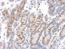 RAB11B Antibody, Novus Biologicals 0.1mL; Unlabeled:Antibodies, Polyclonal