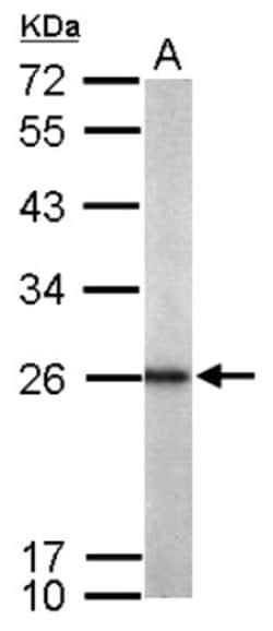 RAB11B Antibody, Novus Biologicals 0.1mL; Unlabeled:Antibodies, Polyclonal