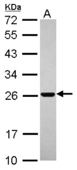 RAB11B Antibody, Novus Biologicals 0.1mL; Unlabeled:Antibodies, Polyclonal