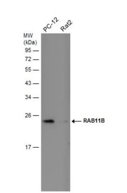RAB11B Antibody, Novus Biologicals 0.1mL; Unlabeled:Antibodies, Polyclonal