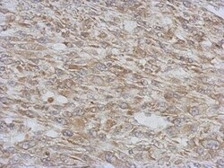 RAB11FIP5 Antibody, Novus Biologicals 0.1mL; Unlabeled:Antibodies, Polyclonal