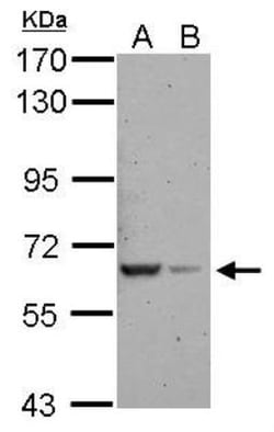 RAB11FIP5 Antibody, Novus Biologicals 0.1mL; Unlabeled:Antibodies, Polyclonal
