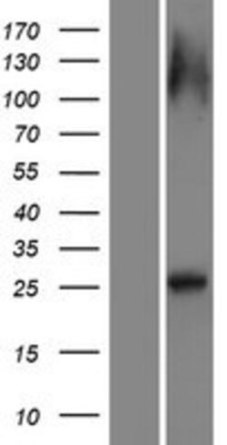 Novus Biologicals&trade;&nbsp;RAB12 Overexpression Lysate