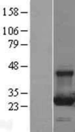 Novus Biologicals&trade;&nbsp;Rab13 Overexpression Lysate