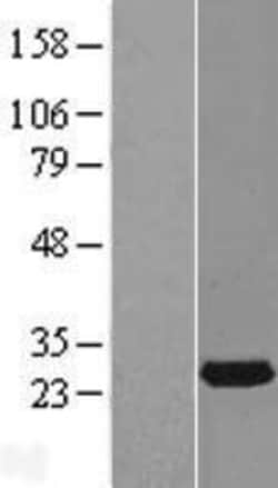 Novus Biologicals&trade;&nbsp;RAB14 Overexpression Lysate
