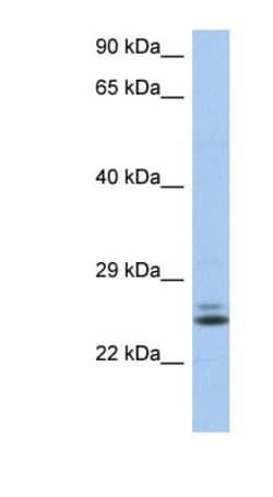 RAB15 Antibody, Novus Biologicals 0.05mg; Unlabeled:Antibodies, Polyclonal