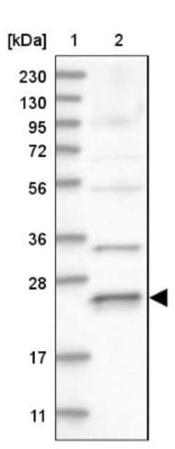 Rab17 Antibody, Novus Biologicals 0.1mL; Unlabeled:Antibodies, Polyclonal