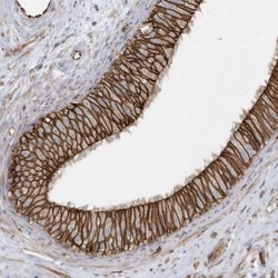 Rab17 Antibody, Novus Biologicals 0.1mL; Unlabeled:Antibodies, Polyclonal