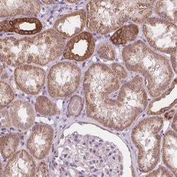 Rab20 Antibody, Novus Biologicals 0.1mL; Unlabeled:Antibodies, Polyclonal