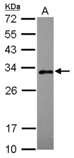 Rab20 Antibody, Novus Biologicals 0.1mL; Unlabeled:Antibodies, Polyclonal