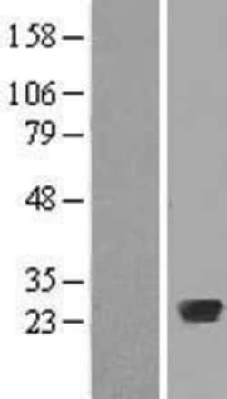 Novus Biologicals&trade;&nbsp;Rab20 Overexpression Lysate
