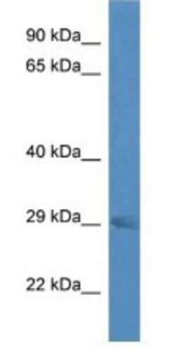 RAB23 Antibody, Novus Biologicals 100&mu;L; Unlabeled:Antibodies, Polyclonal