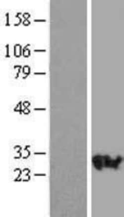 Novus Biologicals&trade;&nbsp;RAB23 Overexpression Lysate