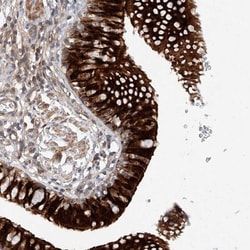 INTS11 Antibody, Novus Biologicals:Antibodies:Primary Antibodies