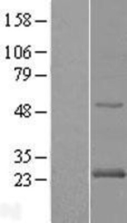 Novus Biologicals&trade;&nbsp;Rab24 Overexpression Lysate