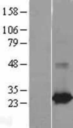 Novus Biologicals&trade;&nbsp;Rab25 Overexpression Lysate