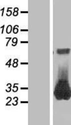 Novus Biologicals&trade;&nbsp;RAB26 Overexpression Lysate