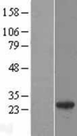Novus Biologicals™ Rab27a Overexpression Lysate