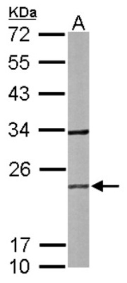RAB2B Antibody, Novus Biologicals 0.1mL; Unlabeled:Antibodies, Polyclonal