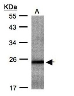 RAB2B Antibody, Novus Biologicals 0.1mL; Unlabeled:Antibodies, Polyclonal