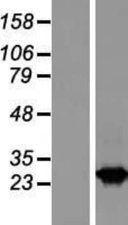 Novus Biologicals&trade;&nbsp;RAB2B Overexpression Lysate