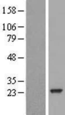 Novus Biologicals&trade;&nbsp;RAB30 Overexpression Lysate