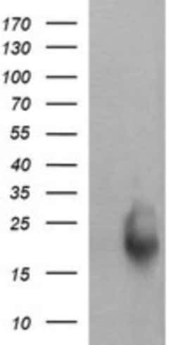 RAB30 Antibody (OTI3E7), Novus Biologicals 0.1mL; Unlabeled:Antibodies,