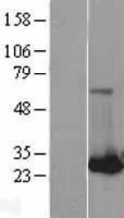 Novus Biologicals&trade;&nbsp;RAB32 Overexpression Lysate