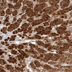 RAB32 Antibody, Novus Biologicals:Antibodies:Primary Antibodies