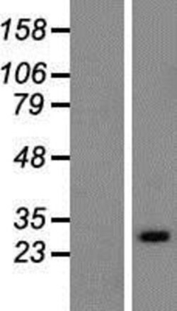 Novus Biologicals&trade;&nbsp;RAB33A Overexpression Lysate
