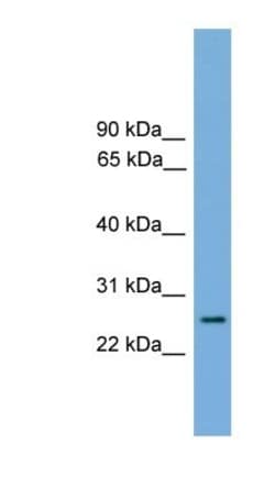 RAB35 Antibody, Novus Biologicals 100&mu;L; Unlabeled:Antibodies, Polyclonal